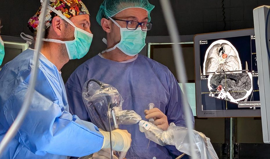HUVR de Sevilla, pionero en Andalucía en extipar tumores del cerebro sin abrir el cráneo