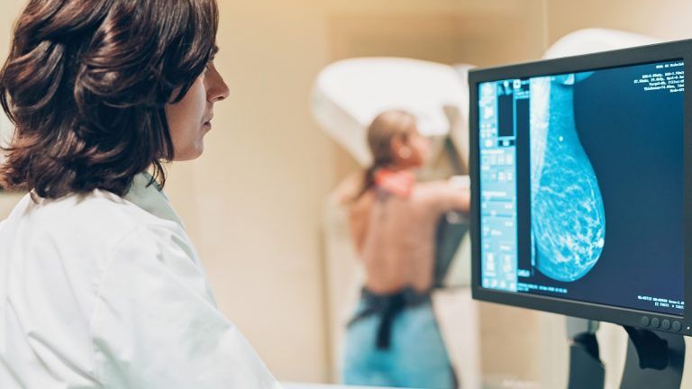 pruebas para la detecci&oacute;n del c&aacute;ncer de mama.